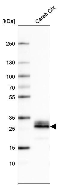 Aquaporin-4 Antibody (CL0178) Western Blot: Aquaporin-4 Antibody (CL0178) [NBP3-52443]