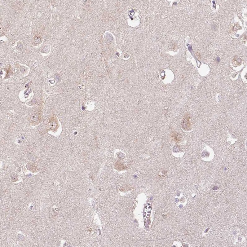 PCM1 Antibody (CL0206) Immunohistochemistry: PCM1 Antibody (CL0206) [NBP3-52444]