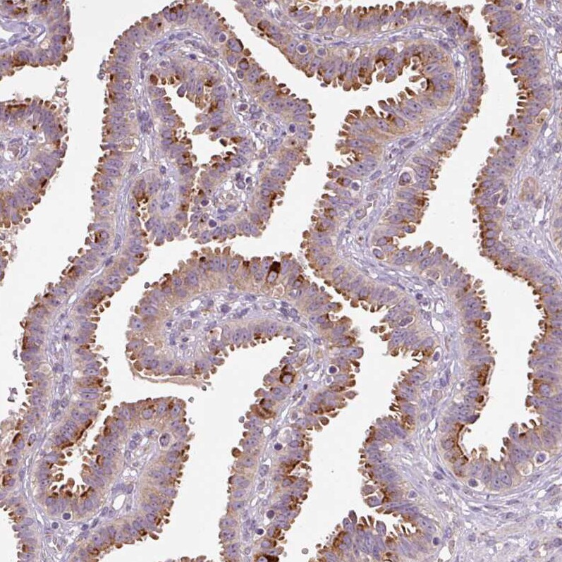 PCM1 Antibody (CL0206) Immunohistochemistry: PCM1 Antibody (CL0206) [NBP3-52444]