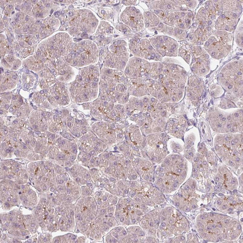PCM1 Antibody (CL0206) Immunohistochemistry: PCM1 Antibody (CL0206) [NBP3-52444]
