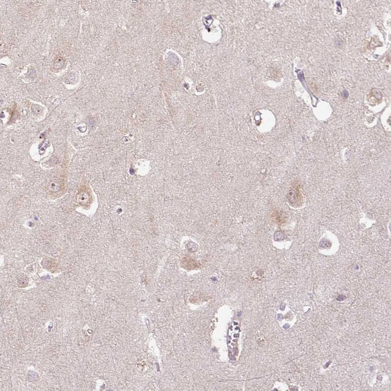 PCM1 Antibody (CL0206) Immunohistochemistry-Paraffin: HMG-CoA Reductase/HMGCR Antibody (CL0260) [NBP3-52447]