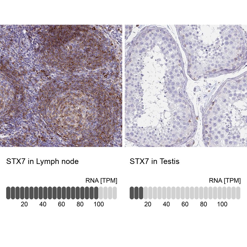 Syntaxin 7 Antibody (CL0257) Immunohistochemistry: Syntaxin 7 Antibody (CL0257) [NBP3-52445]