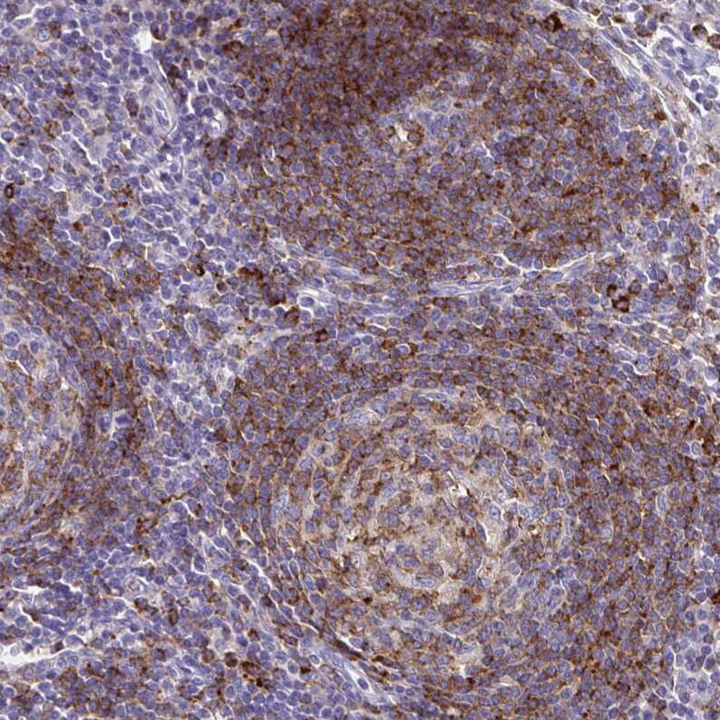 Syntaxin 7 Antibody (CL0257) Immunohistochemistry: Syntaxin 7 Antibody (CL0257) [NBP3-52445]