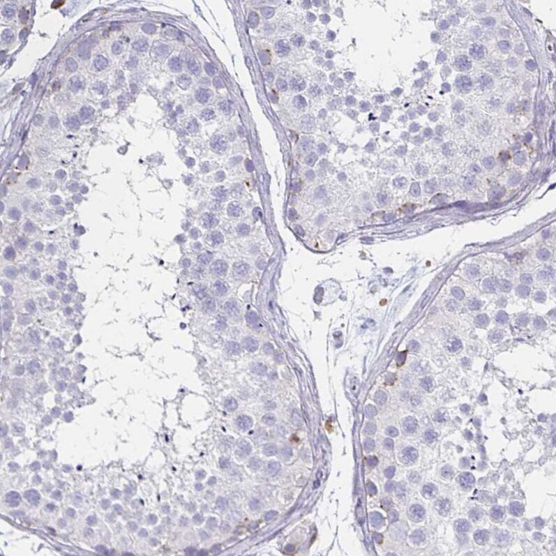 Syntaxin 7 Antibody (CL0257) Immunohistochemistry: Syntaxin 7 Antibody (CL0257) [NBP3-52445]