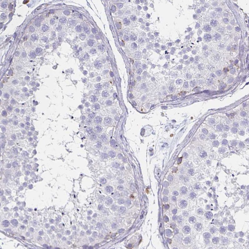 Syntaxin 7 Antibody (CL0257) Immunohistochemistry-Paraffin: PCM1 Antibody (CL0206) [NBP3-52444]