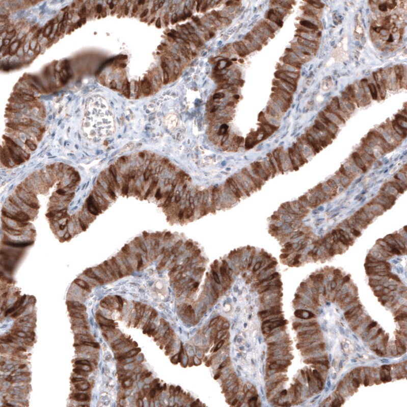 HMG-CoA Reductase/HMGCR Antibody (CL0259) Immunohistochemistry: HMG-CoA Reductase/HMGCR Antibody (CL0259) [NBP3-52446]