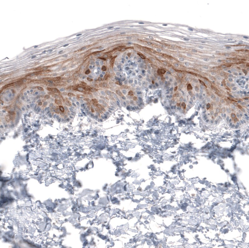HMG-CoA Reductase/HMGCR Antibody (CL0259) Immunohistochemistry: HMG-CoA Reductase/HMGCR Antibody (CL0259) [NBP3-52446]