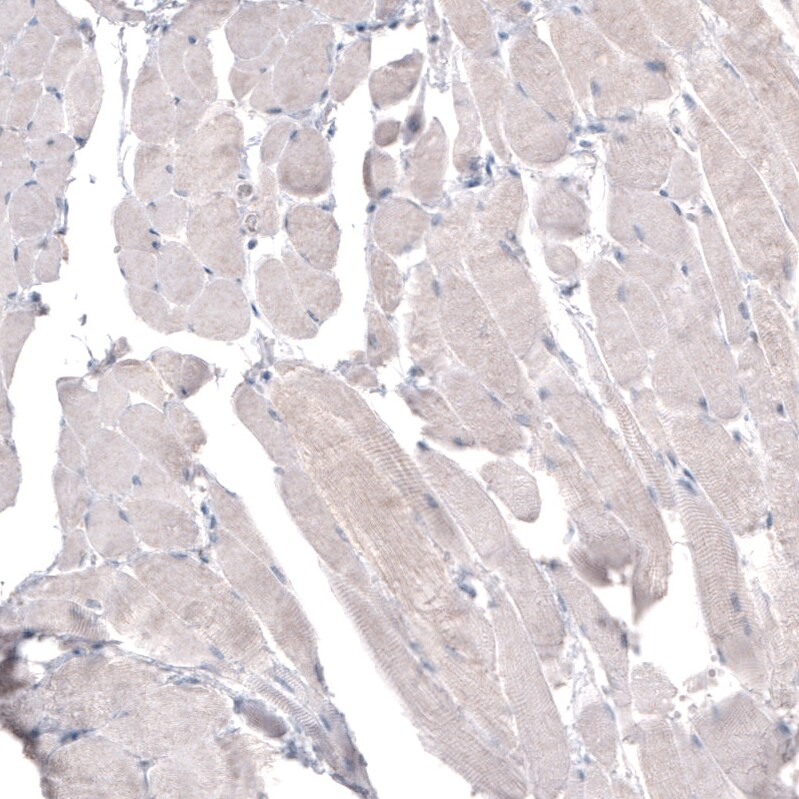 HMG-CoA Reductase/HMGCR Antibody (CL0259) Immunohistochemistry: HMG-CoA Reductase/HMGCR Antibody (CL0259) [NBP3-52446]