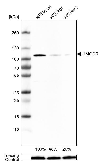 HMG-CoA Reductase/HMGCR Antibody (CL0259) Western Blot: HMG-CoA Reductase/HMGCR Antibody (CL0259) [NBP3-52446]