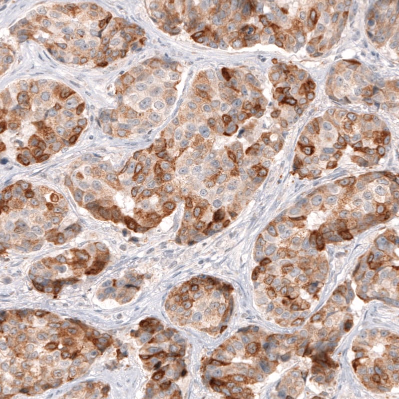 HMG-CoA Reductase/HMGCR Antibody (CL0260) Immunohistochemistry: HMG-CoA Reductase/HMGCR Antibody (CL0260) [NBP3-52447]