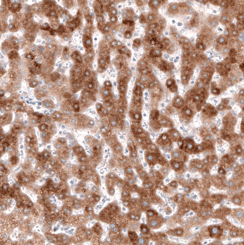 HMG-CoA Reductase/HMGCR Antibody (CL0260) Immunohistochemistry: HMG-CoA Reductase/HMGCR Antibody (CL0260) [NBP3-52447]