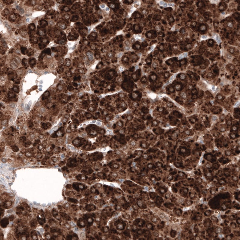 HMG-CoA Reductase/HMGCR Antibody (CL0260) Immunohistochemistry: HMG-CoA Reductase/HMGCR Antibody (CL0260) [NBP3-52447]
