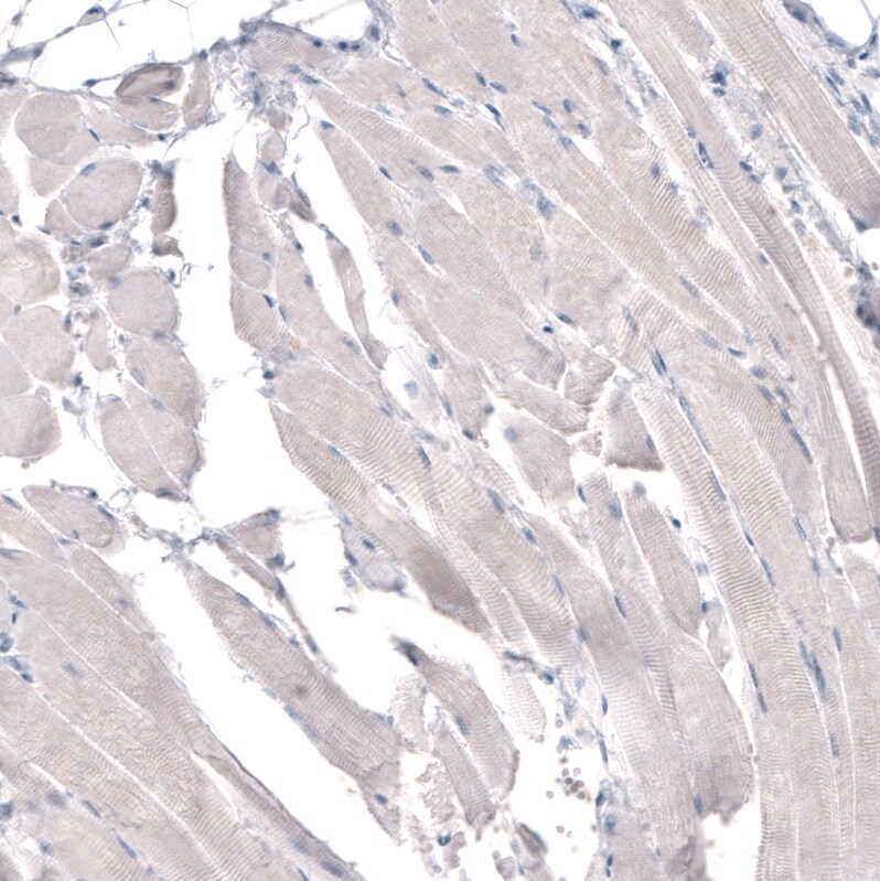 HMG-CoA Reductase/HMGCR Antibody (CL0260) Immunohistochemistry-Paraffin: HMG-CoA Reductase/HMGCR Antibody (CL0260) [NBP3-52447]