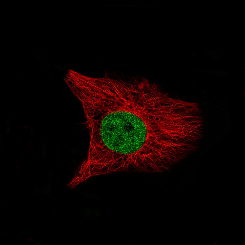 SATB2 Antibody (CL0320) Immunocytochemistry/ Immunofluorescence: SATB2 Antibody (CL0320) [NBP3-52448]