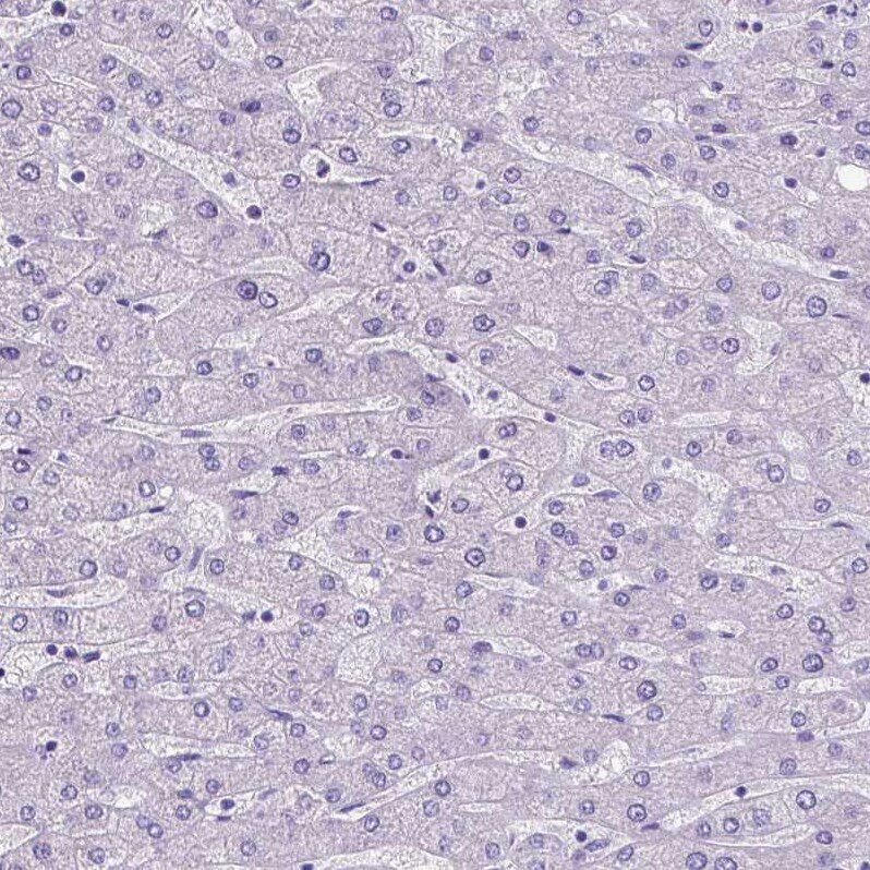 SATB2 Antibody (CL0320) Immunohistochemistry: SATB2 Antibody (CL0320) [NBP3-52448]