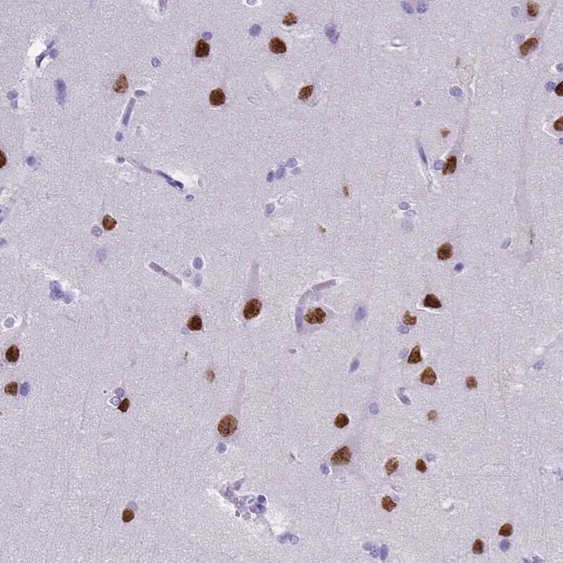 SATB2 Antibody (CL0320) Immunohistochemistry: SATB2 Antibody (CL0320) [NBP3-52448]