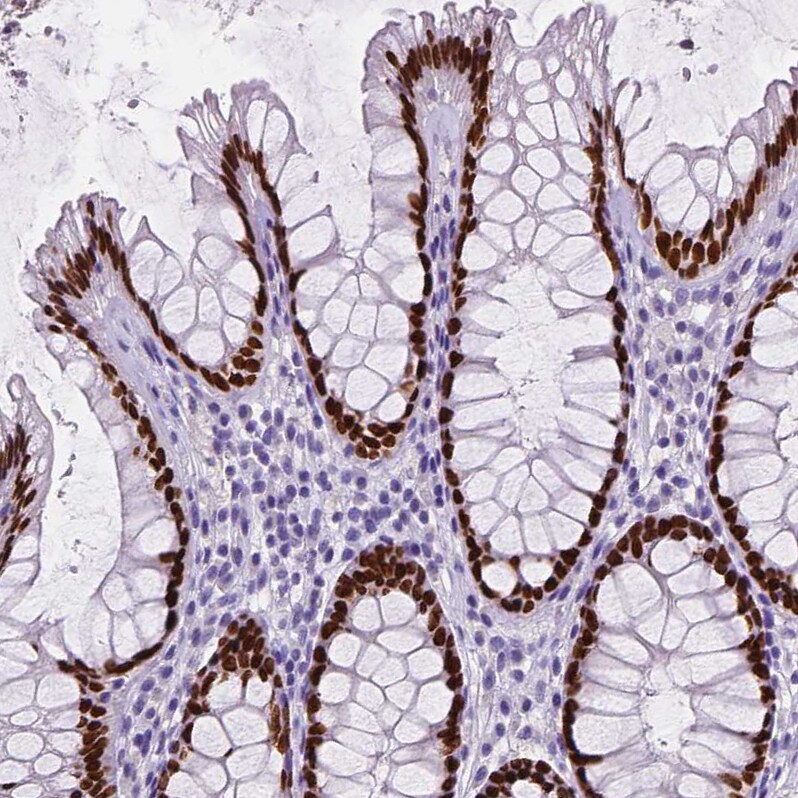 SATB2 Antibody (CL0320) Immunohistochemistry: SATB2 Antibody (CL0320) [NBP3-52448]