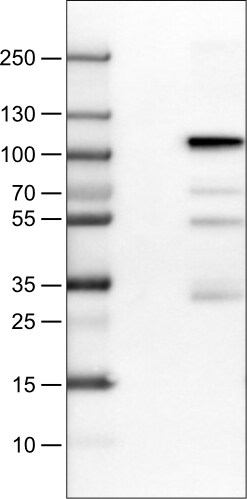 SATB2 Antibody (CL0320) Western Blot: SATB2 Antibody (CL0320) [NBP3-52448]