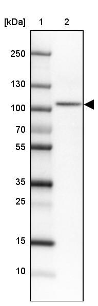 SATB2 Antibody (CL0320) Western Blot: SATB2 Antibody (CL0320) [NBP3-52448]