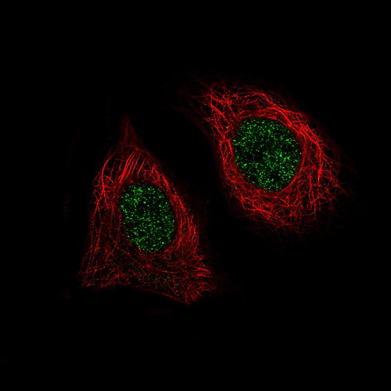 Immunocytochemistry/ Immunofluorescence: BRD4 Antibody (CL1115) [NBP3-52453]