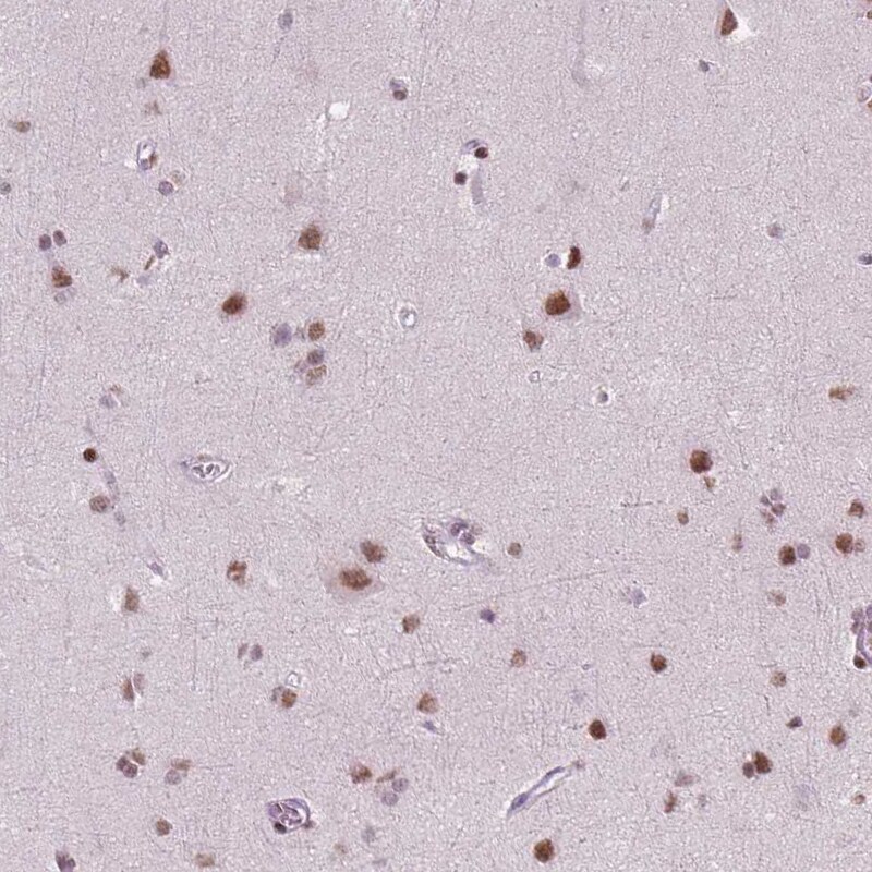 BRD4 Antibody (CL1115) Immunohistochemistry: BRD4 Antibody (CL1115) [NBP3-52453]