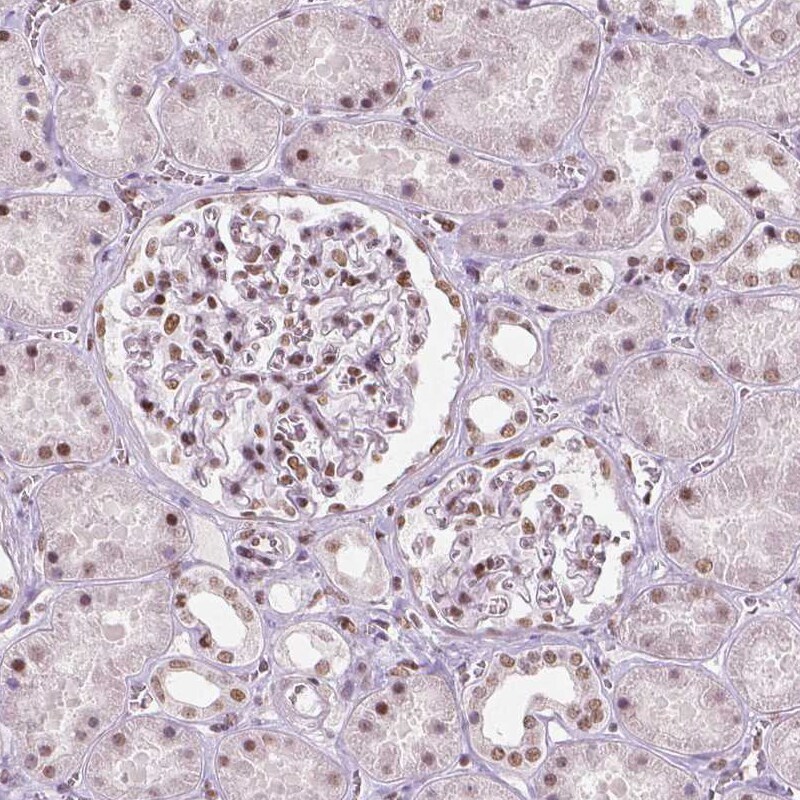 BRD4 Antibody (CL1115) Immunohistochemistry: BRD4 Antibody (CL1115) [NBP3-52453]