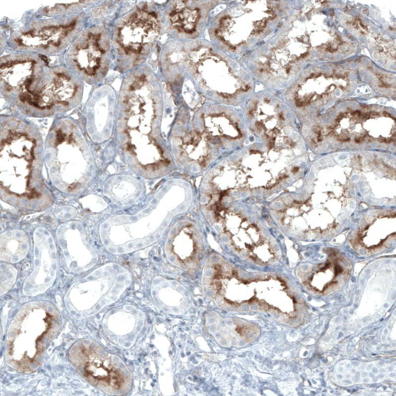 CD90/Thy1 Antibody (CL1028) Immunohistochemistry: CD90/Thy1 Antibody (CL1028) [NBP3-52087]