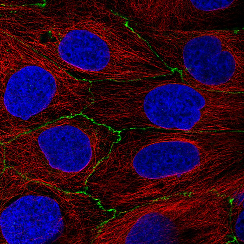 Occludin Antibody (CL1555) Immunocytochemistry/ Immunofluorescence: Occludin Antibody (CL1555) [NBP3-52455]