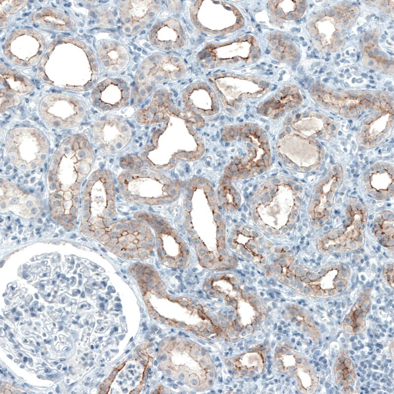 Occludin Antibody (CL1555) Immunohistochemistry: Occludin Antibody (CL1555) [NBP3-52455]