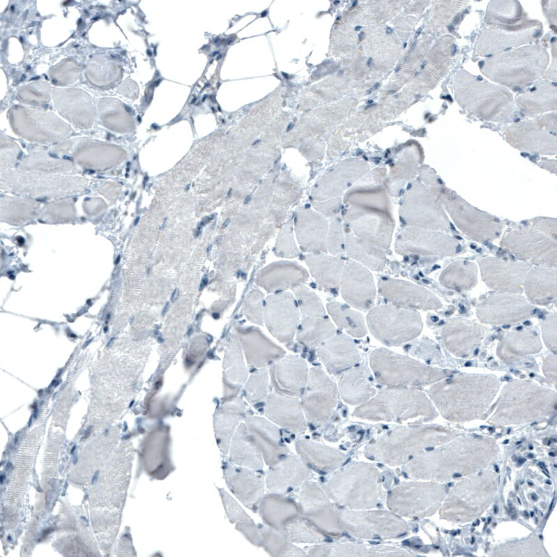 Occludin Antibody (CL1555) Immunohistochemistry: Occludin Antibody (CL1555) [NBP3-52455]