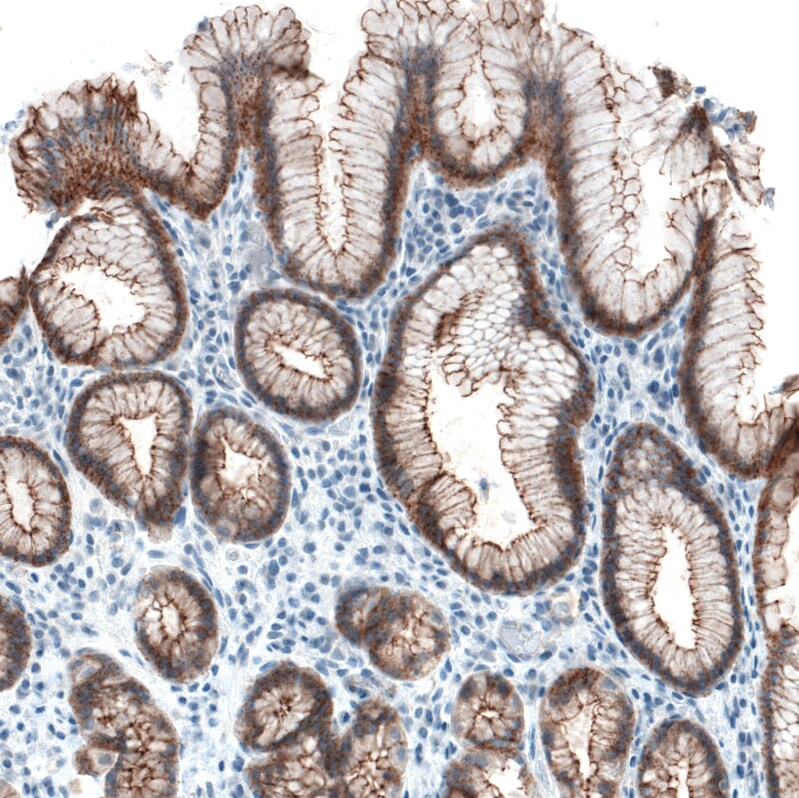 Occludin Antibody (CL1555) Immunohistochemistry: Occludin Antibody (CL1555) [NBP3-52455]
