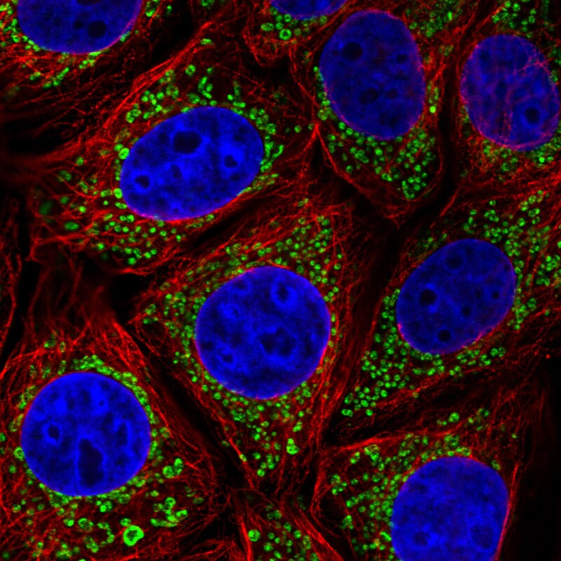 TUFM Antibody (CL2242) Immunocytochemistry/ Immunofluorescence: TUFM Antibody (CL2242) [NBP3-52456]