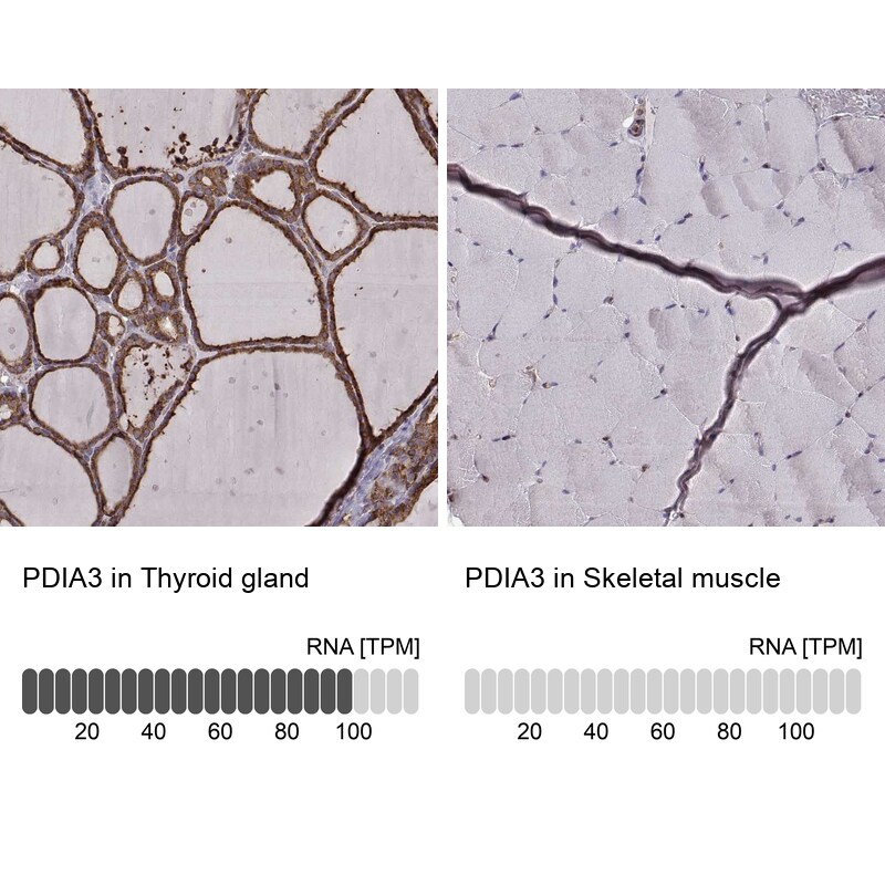 ERp57/PDIA3 Antibody (CL2444) Immunohistochemistry: ERp57/PDIA3 Antibody (CL2444) [NBP3-52458]