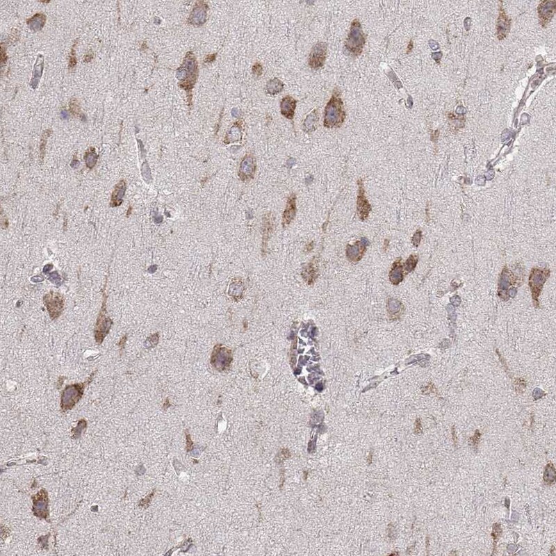 ERp57/PDIA3 Antibody (CL2444) Immunohistochemistry: ERp57/PDIA3 Antibody (CL2444) [NBP3-52458]