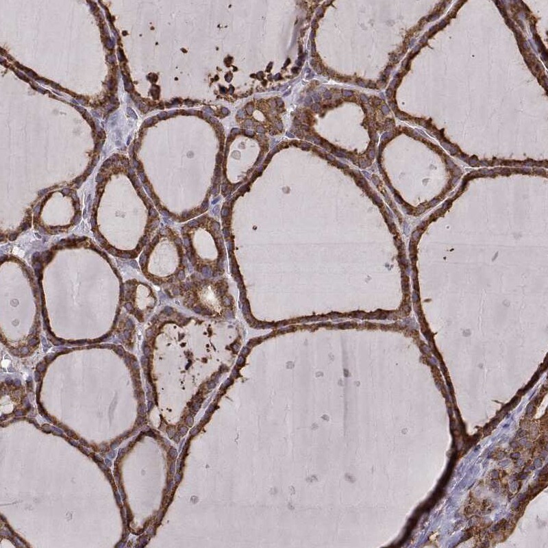 ERp57/PDIA3 Antibody (CL2444) Immunohistochemistry: ERp57/PDIA3 Antibody (CL2444) [NBP3-52458]