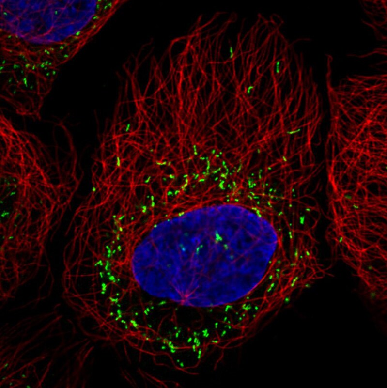 PMP70 Antibody (CL2524) Immunocytochemistry/ Immunofluorescence: PMP70 Antibody (CL2524) [NBP3-52459]
