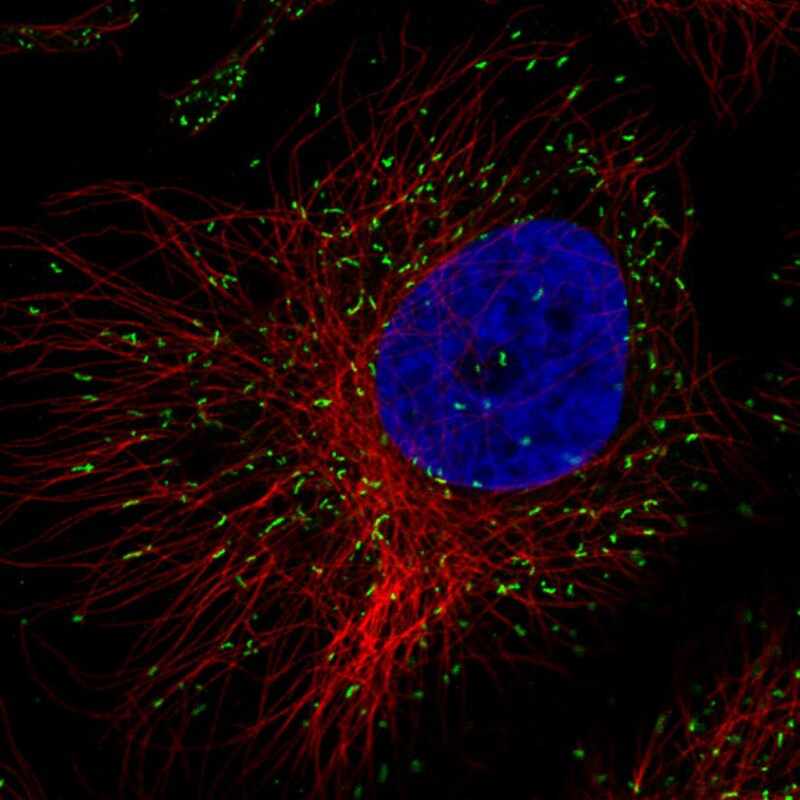 PMP70 Antibody (CL2524) Immunocytochemistry/ Immunofluorescence: PMP70 Antibody (CL2524) [NBP3-52459]