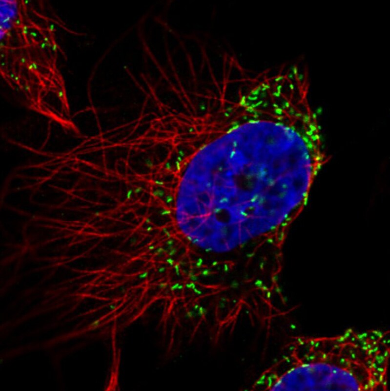 PMP70 Antibody (CL2524) Immunocytochemistry/ Immunofluorescence: PMP70 Antibody (CL2524) [NBP3-52459]