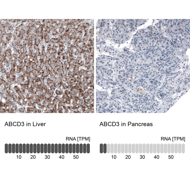 PMP70 Antibody (CL2524) Immunohistochemistry: PMP70 Antibody (CL2524) [NBP3-52459]