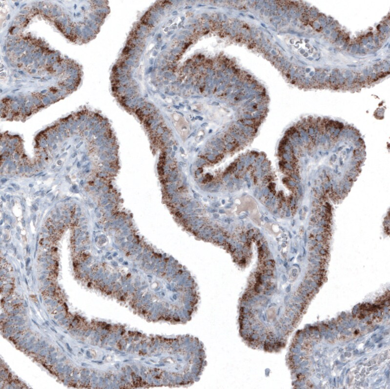 PMP70 Antibody (CL2524) Immunohistochemistry: PMP70 Antibody (CL2524) [NBP3-52459]