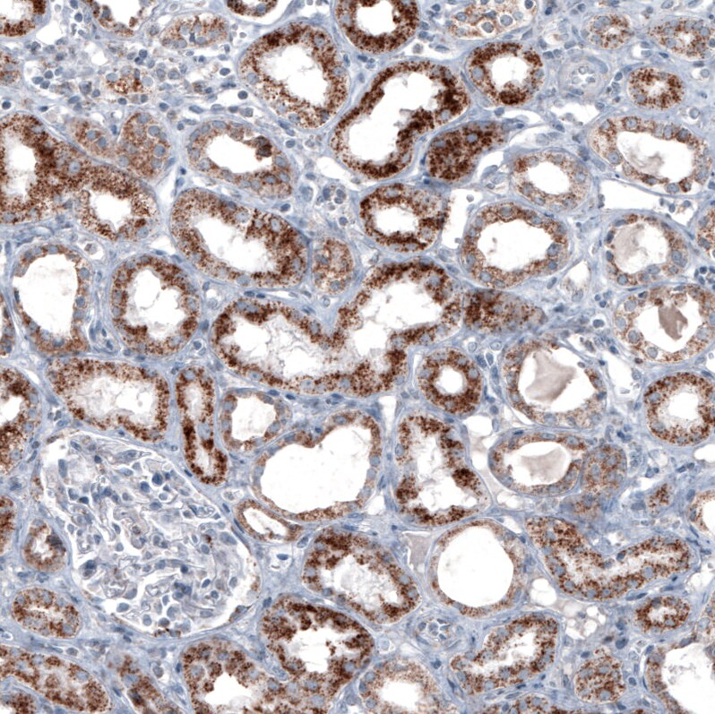 PMP70 Antibody (CL2524) Immunohistochemistry: PMP70 Antibody (CL2524) [NBP3-52459]