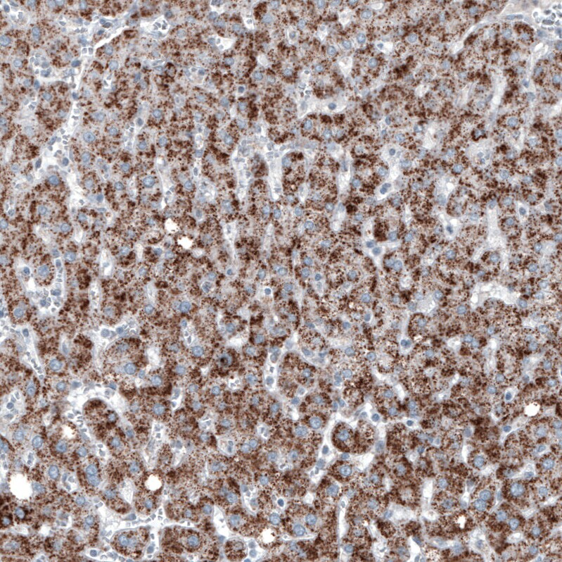 PMP70 Antibody (CL2524) Immunohistochemistry: PMP70 Antibody (CL2524) [NBP3-52459]