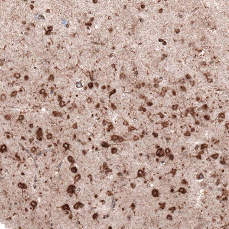 Immunohistochemistry-Paraffin: gp96/HSP90B1/GRP94 Antibody (CL2647) [NBP3-52460]