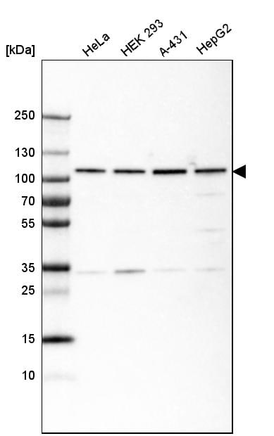 gp96/HSP90B1/GRP94 Antibody (CL2647) Western Blot: gp96/HSP90B1/GRP94 Antibody (CL2647) [NBP3-52460]