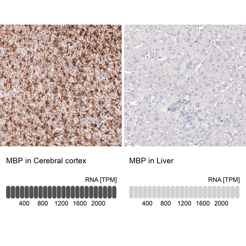 MBP Antibody (CL2829) Immunohistochemistry: MBP Antibody (CL2829) [NBP3-52461]