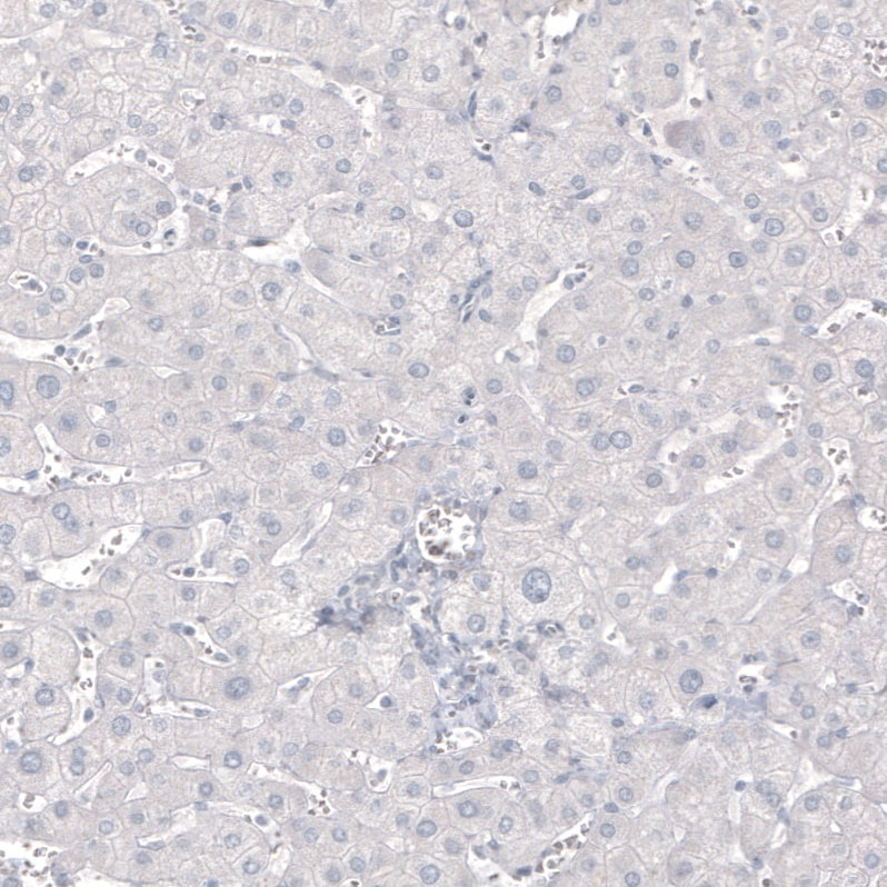 MBP Antibody (CL2829) Immunohistochemistry: MBP Antibody (CL2829) [NBP3-52461]
