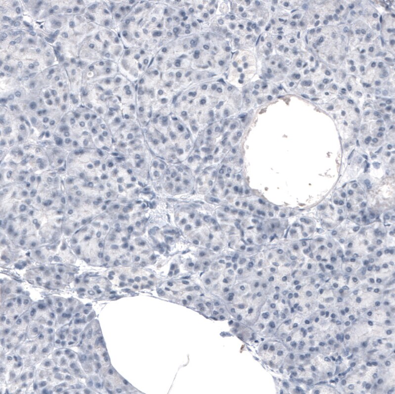 MBP Antibody (CL2829) Immunohistochemistry: MBP Antibody (CL2829) [NBP3-52461]