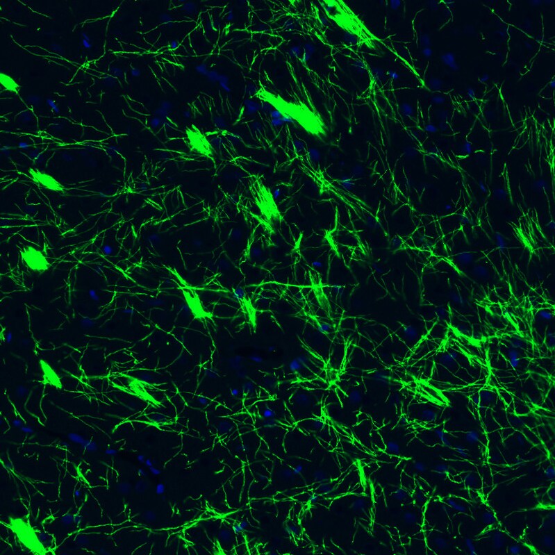 MBP Antibody (CL2829) Immunohistochemistry: MBP Antibody (CL2829) [NBP3-52461]