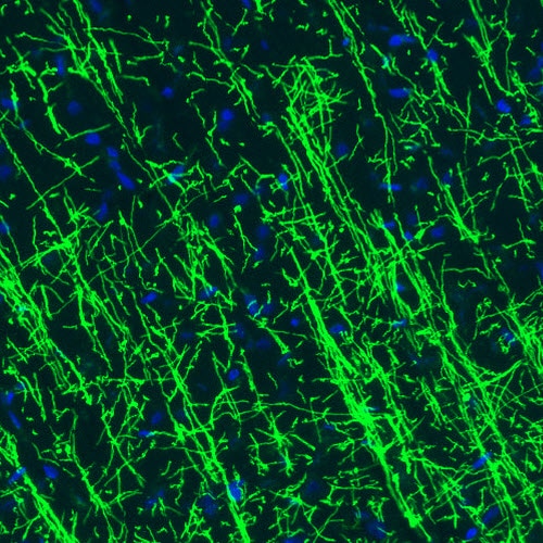 MBP Antibody (CL2829) Immunohistochemistry: MBP Antibody (CL2829) [NBP3-52461]