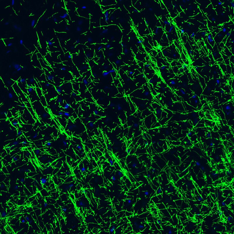 MBP Antibody (CL2829) Immunohistochemistry: MBP Antibody (CL2829) [NBP3-52461]